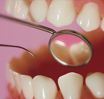 Regular Dental Check Up Services